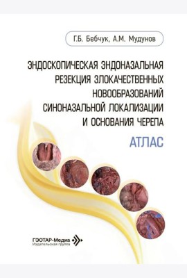 Эндоскопическая эндоназальная резекция злокачественных новообразований синоназальной локализации и основания черепа. Атлас