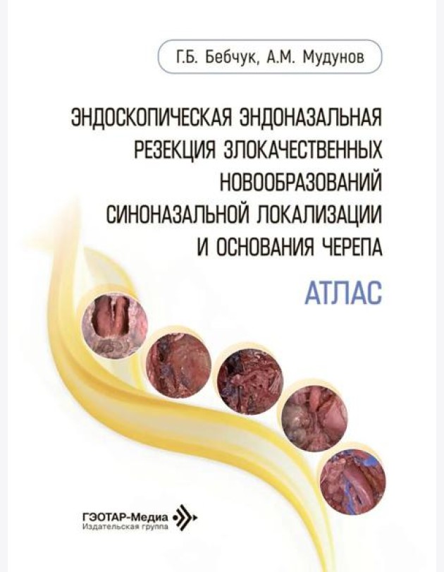 Эндоскопическая эндоназальная резекция злокачественных новообразований синоназальной локализации и основания черепа. Атлас