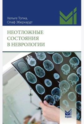 Неотложные состояния в неврологии. 2-е изд