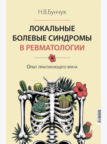 Локальные болевые синдромы в ревматологии. Опыт практикующего врача