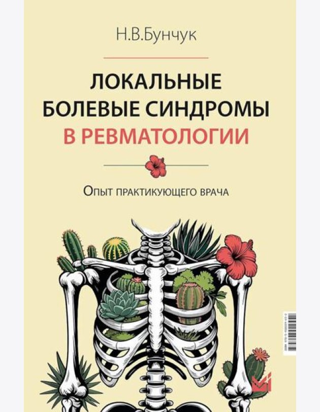 Локальные болевые синдромы в ревматологии. Опыт практикующего врача