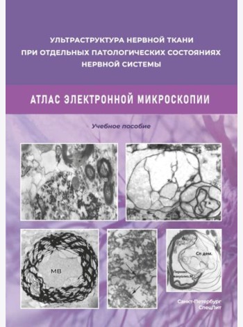 Ультраструктура нервной ткани при отдельных патологических состояниях нервной системы. Атлас электронной микроскопии: Учебное пособие