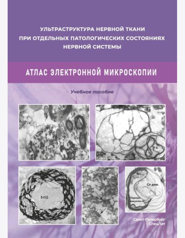 Ультраструктура нервной ткани при отдельных патологических состояниях нервной системы. Атлас электронной микроскопии: Учебное пособие