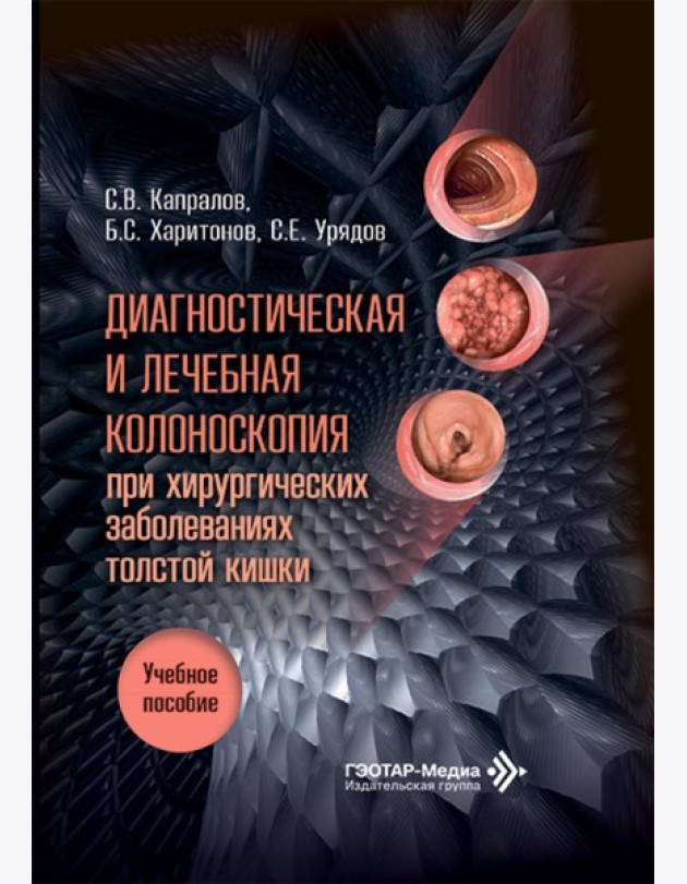 Диагностическая и лечебная колоноскопия при хирургических заболеваниях толстой кишки: Учебное пособие