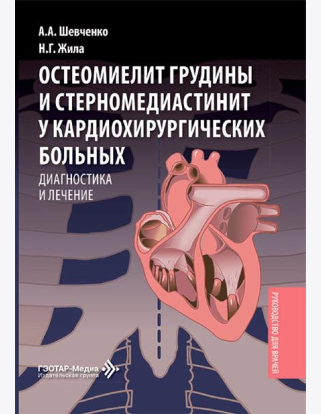 Остеомиелит грудины и стерномедиастинит у кардиохирургических больных. Диагностика и лечение: руководство для врачей