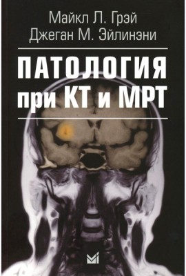 Патология при КТ и МРТ. 3-е изд