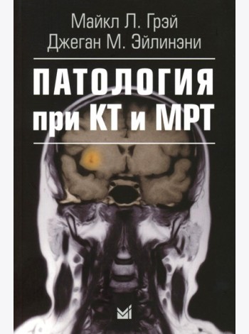 Патология при КТ и МРТ. 3-е изд