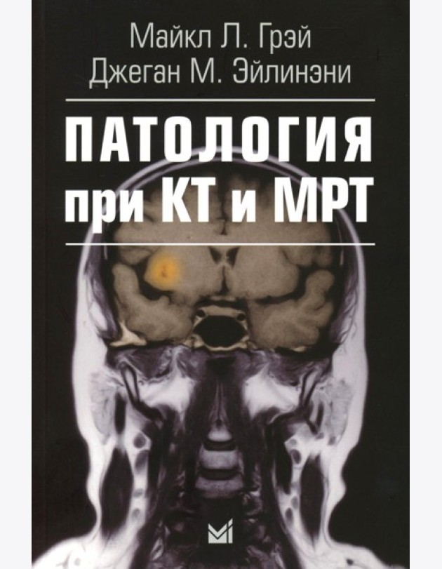Патология при КТ и МРТ. 3-е изд