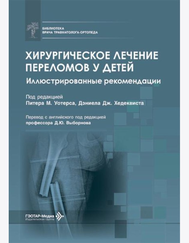 Хирургическое лечение переломов у детей. Иллюстрированные рекомендации