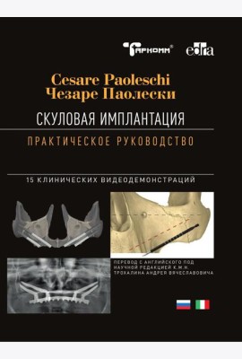 Скуловая имплантация. Практическое руководство - Чезаре Паолески