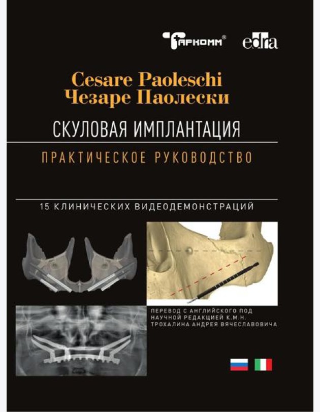 Скуловая имплантация. Практическое руководство - Чезаре Паолески