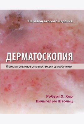 Дерматоскопия. Иллюстрированное руководство для самообучения