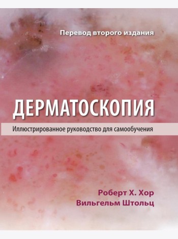 Дерматоскопия. Иллюстрированное руководство для самообучения