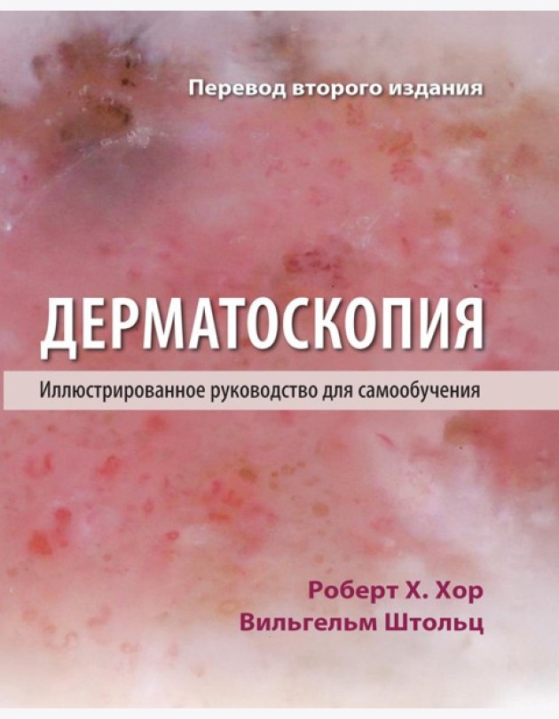 Дерматоскопия. Иллюстрированное руководство для самообучения