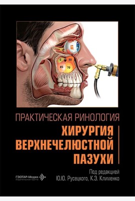 Практическая ринология: хирургия верхнечелюстной пазухи