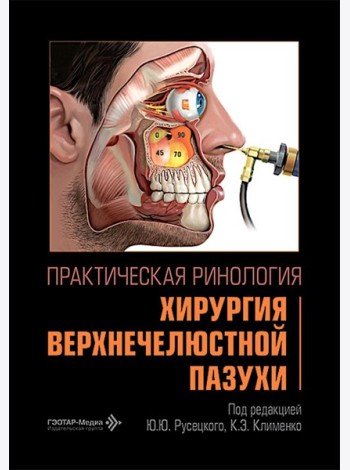 Практическая ринология: хирургия верхнечелюстной пазухи
