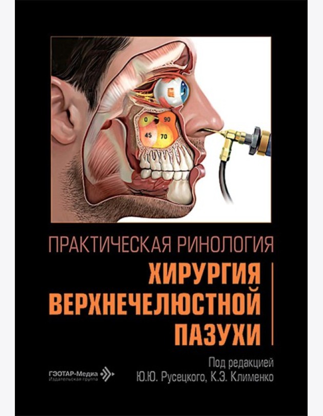 Практическая ринология: хирургия верхнечелюстной пазухи