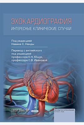 Эхокардиография. Интересные клинические случаи