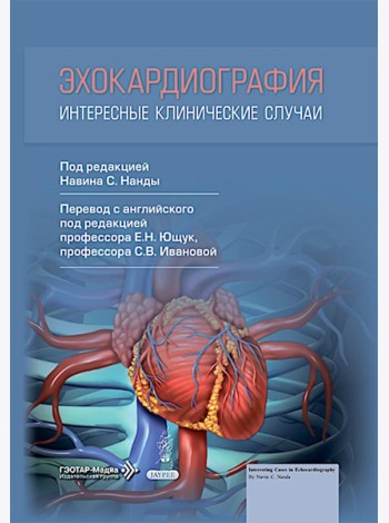 Эхокардиография. Интересные клинические случаи