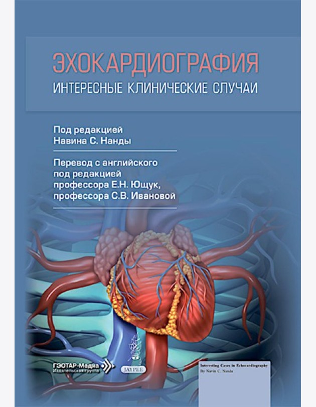 Эхокардиография. Интересные клинические случаи