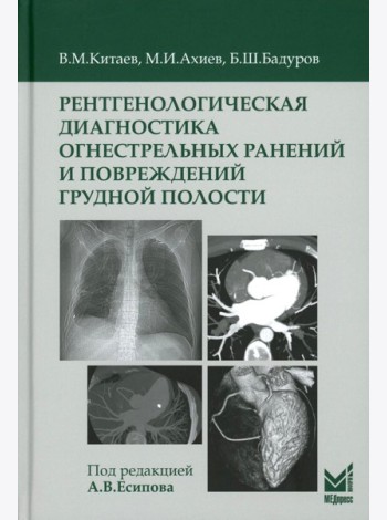 Рентгенологическая диагностика огнестрельных ранений и повреждений грудной полости. 2-е изд., перераб. и доп
