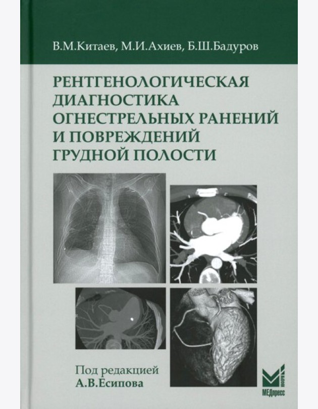 Рентгенологическая диагностика огнестрельных ранений и повреждений грудной полости. 2-е изд., перераб. и доп