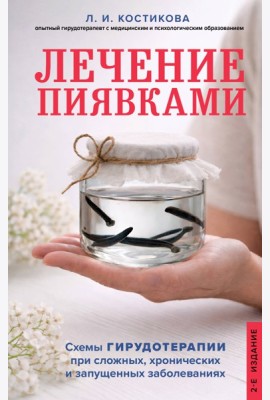 Лечение пиявками. Схемы гирудотерапии при сложных, хронических и запущенных заболеваниях