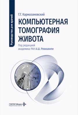 Компьютерная томография живота: руководство для врачей