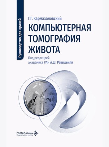 Компьютерная томография живота: руководство для врачей