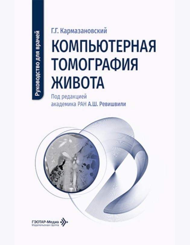 Компьютерная томография живота: руководство для врачей