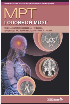 МРТ. Головной мозг: руководство для врачей
