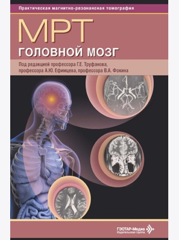 МРТ. Головной мозг: руководство для врачей